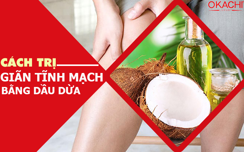 Dầu dừa trị giãn tĩnh mạch có tốt hay không