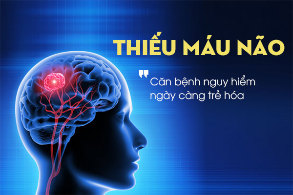 Thiếu máu lên não là bệnh gì nên ăn gì để cải thiện sức khỏe