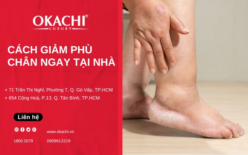 cách giảm sưng phù chân ngay tại nhà