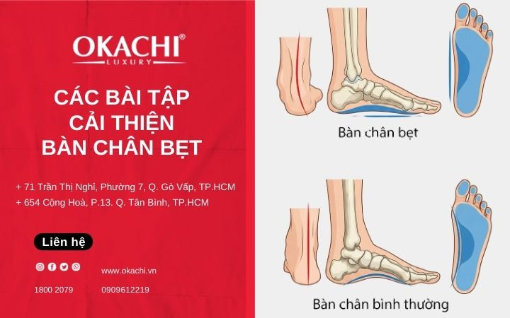 Các bài tập cải thiện bàn chân bẹt DỄ THỰC HIỆN

