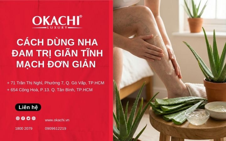 Cách dùng nha đam trị giãn tĩnh mạch ĐƠN GIẢN tại nhà