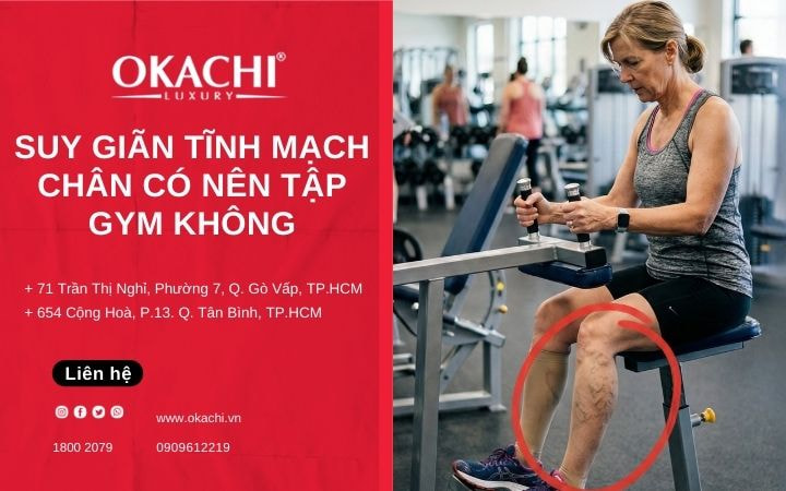 Người bị suy giãn tĩnh mạch chân có nên tập gym không