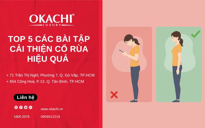 Top 5 các bài tập cải thiện cổ rùa chỉnh dáng HIỆU QUẢ NHANH

