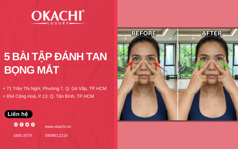 Bài tập đánh tan bọng mắt