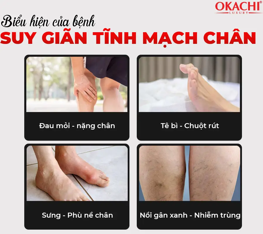 Máy nén ép trị liệu suy giãn tĩnh mạch OKACHI LUXURY JP-2000