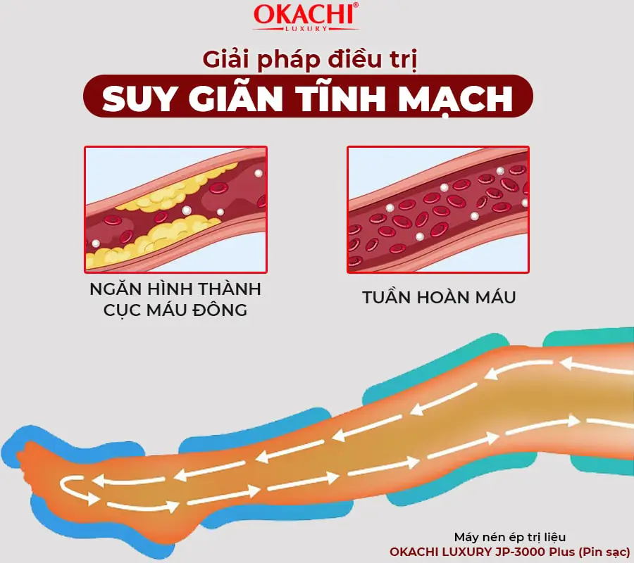 Máy nén ép TRỊ LIỆU suy giãn tĩnh mạch Okachi luxury JP-3000 Plus pin sạc