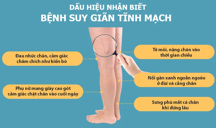 Phụ kiện phần chân máy nén ép suy giãn tĩnh mạch OKACHI